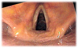 Larynx Vocal Cords (looking down the trachea or windpipe)